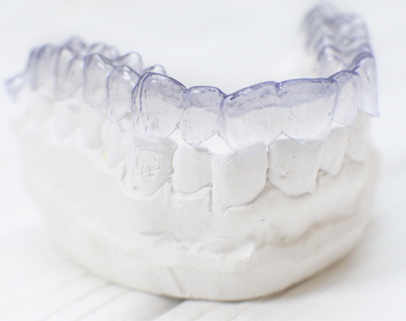 Invisalign Braces Sitting on Molds in Raleigh, NC 