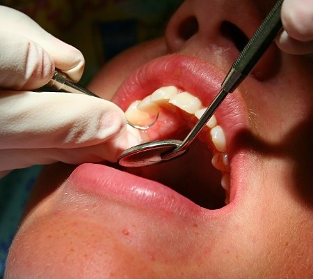 Dental Hygienist Examining Teeth in Raleigh, NC 